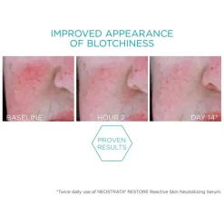 Neostrata Restore Redness Neutralising Serum For Sensitive Skin 29g -More Than Just a Hair care products shop. 11296460 2114928009507013